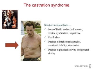 Short-term side-effects… Loss of libido and sexual interest, erectile dysfunction, impotence Hot flushes  Decline in intellectual capacity, emotional liability, depression Decline in physical activity and general vitality The castration syndrome 