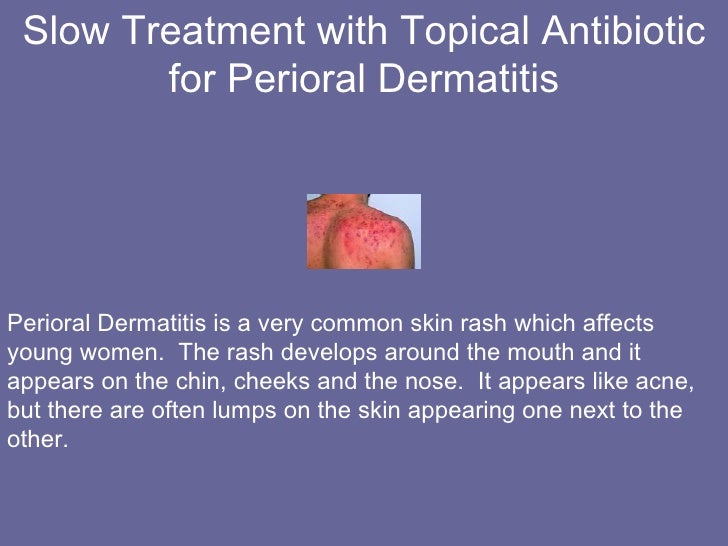 Doxycycline Skin