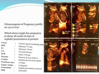 Ultrasonogram of Pregnancy profile
on 24/12/2022
Which shows single live pregnancy
at about 28 weeks 06 days in
cephalic presentation at present
 