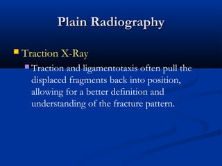 Plain Radiography


Traction X-Ray
 Traction

and ligamentotaxis often pull the
displaced fragments back into position,
allowing for a better definition and
understanding of the fracture pattern.

 