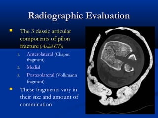 Radiographic Evaluation
The 3 classic articular
components of pilon
fracture (Axial CT):



1.

Anterolateral (Chaput
fragment)

2.
3.

Medial
Posterolateral (Volkmann
fragment)



These fragments vary in
their size and amount of
comminution

 
