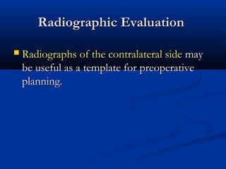 Radiographic Evaluation


Radiographs of the contralateral side may
be useful as a template for preoperative
planning.

 