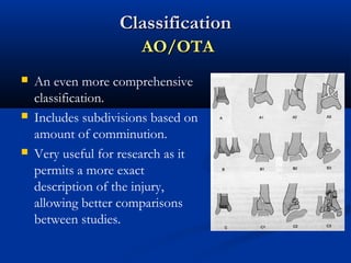 Classification
AO/OTA






An even more comprehensive
classification.
Includes subdivisions based on
amount of comminution.
Very useful for research as it
permits a more exact
description of the injury,
allowing better comparisons
between studies.

 