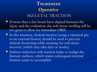 Treatment
Operative
SKELETAL TRACTION






If more than a few hours have elapsed between the
injury and the evaluation, the soft-tissue swelling will be
too great to allow for immediate ORIF.
In this situation, skeletal traction (using a calcaneal pin
or an external fixator) should be used to prevent
skeletal shortening while awaiting for soft-tissue
recovery (which may take days or weeks).
Indirect reduction with traction helps to realign the
fracture surfaces, which makes subsequent internal
fixation easier to accomplish.

 