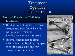 Treatment
Operative
SURGICAL TACTIC
External Fixation as Definitive
Treatment:
 This has been of interest in recent
years, particularly for its benefits
with respect to minimal
interference with the soft tissue.
 External fixators can be either
unilateral or circular, they may span
or not the ankle joint and may
permit or not its motion.

Portable traction

 