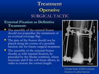 Treatment
Operative
SURGICAL TACTIC
External Fixation as Definitive
Treatment:






The assembly of the external fixator
should not jeopardize the attainment of
an eventual coverage flap.
The pins of the fixator should not be
placed along the course of a possible
incision site for future surgical treatment.
The assembly of the external fixator
should, as with internal fixation, be
preceded by the fibular synthesis, where
necessary and if the soft tissue allows, in
order to restore the correct length.
Circular frame (LiMA) external
fixation of a pilon fracture

 
