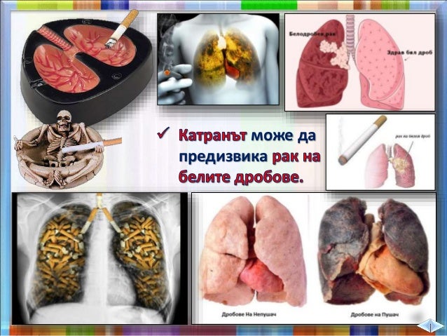 39. Здравословен начин на живот - ЧП, 4 клас, Булвест