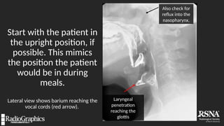 39.5.DiSantis.pptx barium study procedures | PPTX