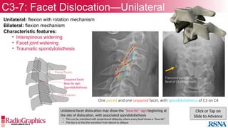 39.3.Skalski.pptx presentation on radiology | PPTX