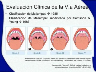 Evaluación Clínica de la Vía Aérea
• Clasificación de Mallampati  1985
• Clasificación de Mallampati modificada por Samsoon &
  Young  1987




            Mallampati SR, Gatt SP, Gugino LD, Desai SP, Waraka B, Freiberger D, et al. Clinical sign to
            predict difficult tracheal intubation: a procpective study. Can Anaesth Soc J 1985; 32:429-434


                                                   Samsson GL, Young JR. Difficult tracheal intubation: a
                                                     retrospective study. Anaesthesia 1987; 42:487-490
 