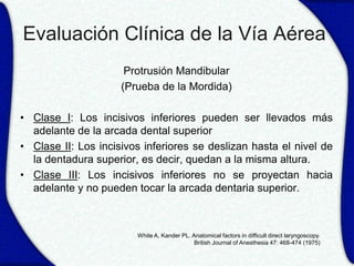 Evaluación Clínica de la Vía Aérea
                      Protrusión Mandibular
                     (Prueba de la Mordida)

• Clase I: Los incisivos inferiores pueden ser llevados más
  adelante de la arcada dental superior
• Clase II: Los incisivos inferiores se deslizan hasta el nivel de
  la dentadura superior, es decir, quedan a la misma altura.
• Clase III: Los incisivos inferiores no se proyectan hacia
  adelante y no pueden tocar la arcada dentaria superior.



                        White A, Kander PL. Anatomical factors in difficult direct laryngoscopy.
                                             British Journal of Anesthesia 47: 468-474 (1975)
 