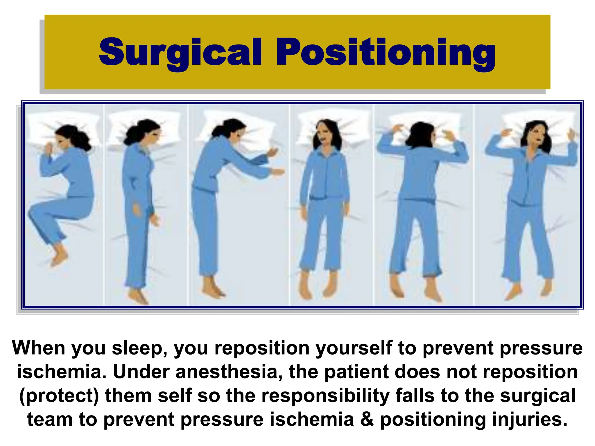 Surgical Positioning
When you sleep, you reposition yourself to prevent pressure
ischemia. Under anesthesia, the patient does not reposition
(protect) them self so the responsibility falls to the surgical
team to prevent pressure ischemia & positioning injuries.
 