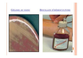 GÉLOSE AU SANG BOUILLON D’HÉMOCULTURE
 