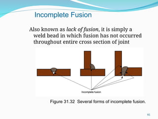 Also known as lack of fusion, it is simply a
weld bead in which fusion has not occurred
throughout entire cross section of joint
Figure 31.32 Several forms of incomplete fusion.
Incomplete Fusion
95
 