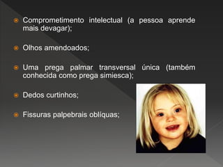  Comprometimento intelectual (a pessoa aprende
mais devagar);
 Olhos amendoados;
 Uma prega palmar transversal única (também
conhecida como prega simiesca);
 Dedos curtinhos;
 Fissuras palpebrais oblíquas;
 