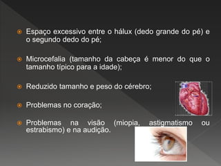  Espaço excessivo entre o hálux (dedo grande do pé) e
o segundo dedo do pé;
 Microcefalia (tamanho da cabeça é menor do que o
tamanho típico para a idade);
 Reduzido tamanho e peso do cérebro;
 Problemas no coração;
 Problemas na visão (miopia, astigmatismo ou
estrabismo) e na audição.
 