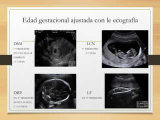 Edad gestacional ajustada con le ecografía
DSM LCN
1° TRIMESTRE 1° TRIMESTRE
SIN VISUALIZAR (5-7 DIAS)
EMBRION
( 5-7 DIAS)
DBP LF
EN 2° TRIMESTRE EN 3° TRIMESTRE
(HASTA 24 SEM.)
(7 A 10 DIAS)
 
