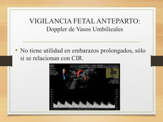 VIGILANCIA FETALANTEPARTO:
Doppler de Vasos Umbilicales
• No tiene utilidad en embarazos prolongados, sólo
si se relacionan con CIR.
 