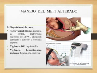 MANEJO DEL MEFI ALTERADO
1. Diagnóstico de la causa:
• Tacto vaginal: DG (ej. prolapso
de cordón, metrorragia
sugerente de DPPNI, dilatación
cervical) y conocer la cercanía
al parto.
• Vigilancia DU: taquisistolía.
• Vigilancia hemodinámica
materna: hipotensión materna.
 