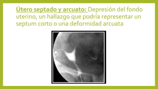 Útero septado y arcuato: Depresión del fondo
uterino, un hallazgo que podría representar un
septum corto o una deformidad arcuata
 