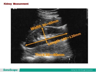 Basic training of ultrasound