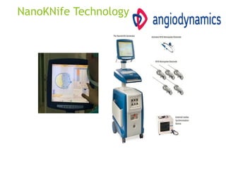 NanoKNife Technology
 
