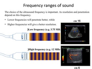 Frequency ranges of sound
The choice of the ultrasound frequency is important. As resolution and penetration
depend on this frequency.
• Lower frequencies will penetrate better, while
• Higher frequencies will give a better resolution.
Low frequency (e.g. 3.75 MHz(
High frequency (e.g. 12 MHz(
15cm
6cm
 