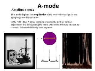 A-modeAmplitude mode.
This mode displays the amplitudes of the received echo signals as a
graph against depth (= time(.
In the “old” days A-mode scanning was mainly used for cardiac
applications and for scanning the brain. Only one ultrasound line can be
viewed. This mode is hardly used anymore.
 