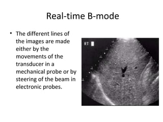 Real-time B-mode
• The different lines of
the images are made
either by the
movements of the
transducer in a
mechanical probe or by
steering of the beam in
electronic probes.
 