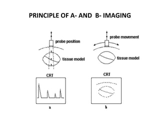 PRINCIPLE OF A- AND B- IMAGING
 