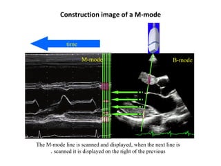 Construction image of a M-mode
The M-mode line is scanned and displayed, when the next line is
scanned it is displayed on the right of the previous.
B-modeM-mode
time
 