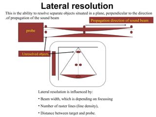 Lateral resolution
This is the ability to resolve separate objects situated in a plane, perpendicular to the direction
of propagation of the sound beam.
probe
Unresolved objects
Propagation direction of sound beam
Lateral resolution is influenced by:
• Beam width, which is depending on focussing
• Number of raster lines (line density),
• Distance between target and probe.
 