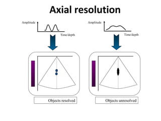 Axial resolution
Time/depth
Amplitude Amplitude
Time/depth
Objects resolved Objects unresolved
 