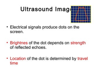Ultrasound Image
• Electrical signals produce dots on the
screen.
• Brightnes of the dot depends on strength
of reflected echoes.
• Location of the dot is determined by travel
time
 
