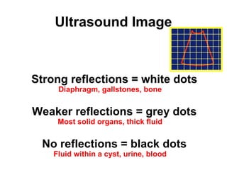 Ultrasound Image
Strong reflections = white dots
Diaphragm, gallstones, bone
Weaker reflections = grey dots
Most solid organs, thick fluid
No reflections = black dots
Fluid within a cyst, urine, blood
 