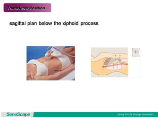 Basic training of ultrasound