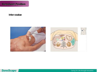Basic training of ultrasound
