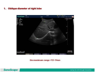 Basic training of ultrasound