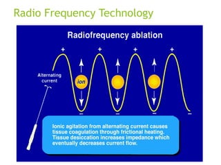 Radio Frequency Technology
 