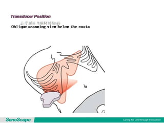 Basic training of ultrasound
