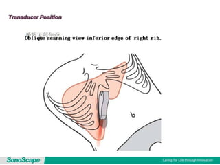 Basic training of ultrasound