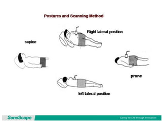 Basic training of ultrasound