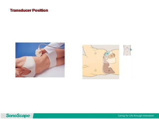Basic training of ultrasound