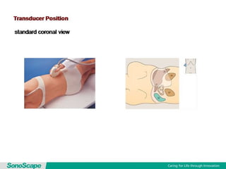 Basic training of ultrasound