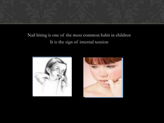 Nail biting is one of the most common habit in children
It is the sign of internal tension
 