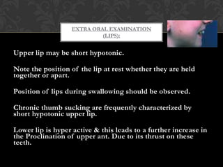 Upper lip may be short hypotonic.
Note the position of the lip at rest whether they are held
together or apart.
Position of lips during swallowing should be observed.
Chronic thumb sucking are frequently characterized by
short hypotonic upper lip.
Lower lip is hyper active & this leads to a further increase in
the Proclination of upper ant. Due to its thrust on these
teeth.
EXTRA ORAL EXAMINATION
(LIPS):
 