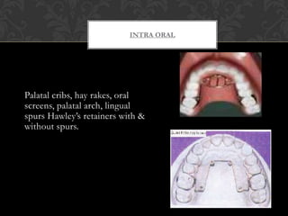 INTRA ORAL
Palatal cribs, hay rakes, oral
screens, palatal arch, lingual
spurs Hawley’s retainers with &
without spurs.
 