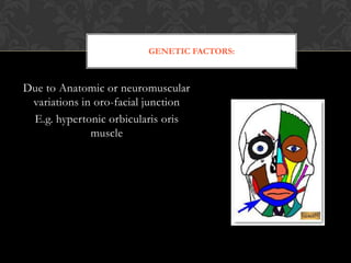 GENETIC FACTORS:
Due to Anatomic or neuromuscular
variations in oro-facial junction
E.g. hypertonic orbicularis oris
muscle
 