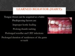 LEARNED BEHAVIOR (HABIT):
Tongue thrust can be acquired as a habit
Predisposing factors are
Improper bottle feeding
Prolong thumb sucking
Prolonged tonsillar and URT infections
Prolonged duration of tenderness of the gums
or teeth
 