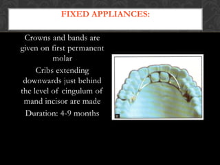 FIXED APPLIANCES:
Crowns and bands are
given on first permanent
molar
Cribs extending
downwards just behind
the level of cingulum of
mand incisor are made
Duration: 4-9 months
 